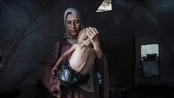 Aworan obinrin kan to gbe ọmọ ti ebi ti pa ru kan egungun dani.