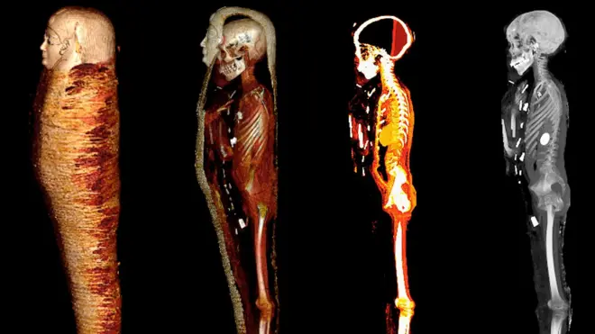 mummified body of a wealthy ancient Egyptian “golden boy” from 2,300 years ago and found 49 amulets of 21 different types on him