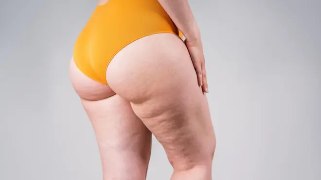 Жена у доњем вешу са целулитом на ногама