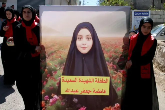 Seorang korban ledakan perangkat komunikasi di Lebanon.