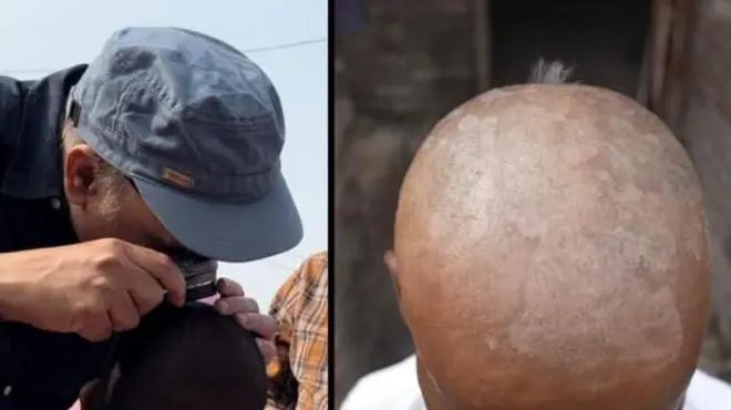 несподіване облисіння