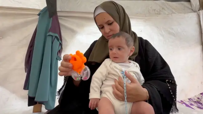 Beba posle operacije srca vraćena u ratnu zonu