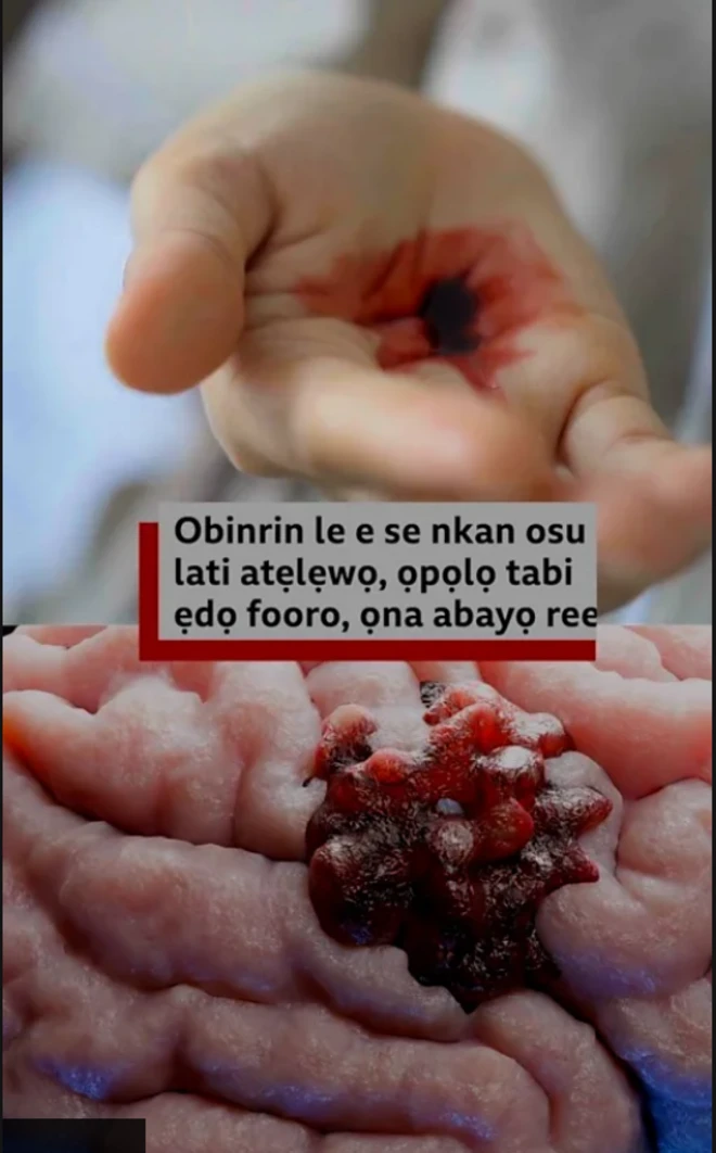 Aworan nkan osu lati owo