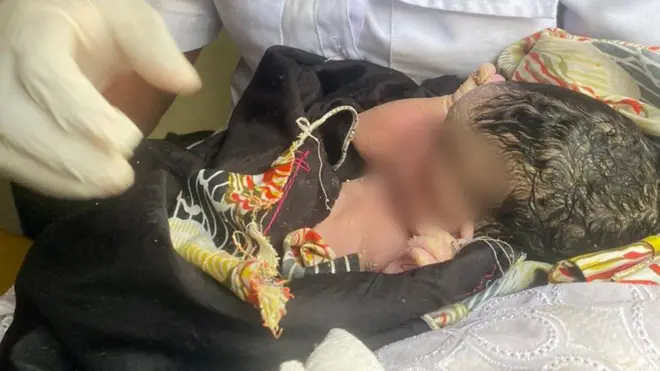 Uno mugore n'umwana wiwe baciye bajanwa ku bitaro 