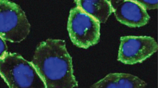 کارولین برتوزی توانست نقشه بیوملکول گلیکان – اینجا به رنگ سبز – را تهیه کند