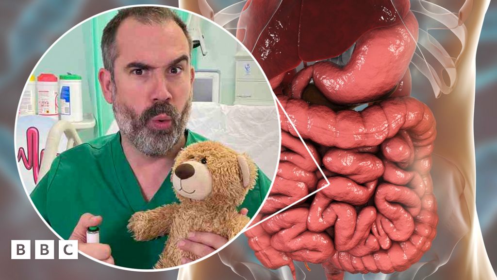 Operation Ouch | Top seven facts about poo and farts