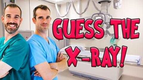 Two doctors standing back to back, with a title saying 'guess the x-ray'.