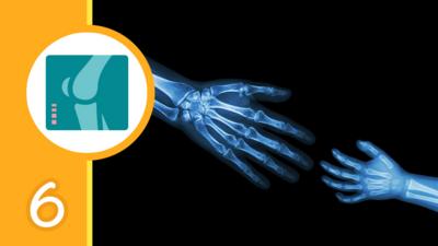 An X Ray of an adult handing reaching out to a child's hand and a graphic of an X-ray
