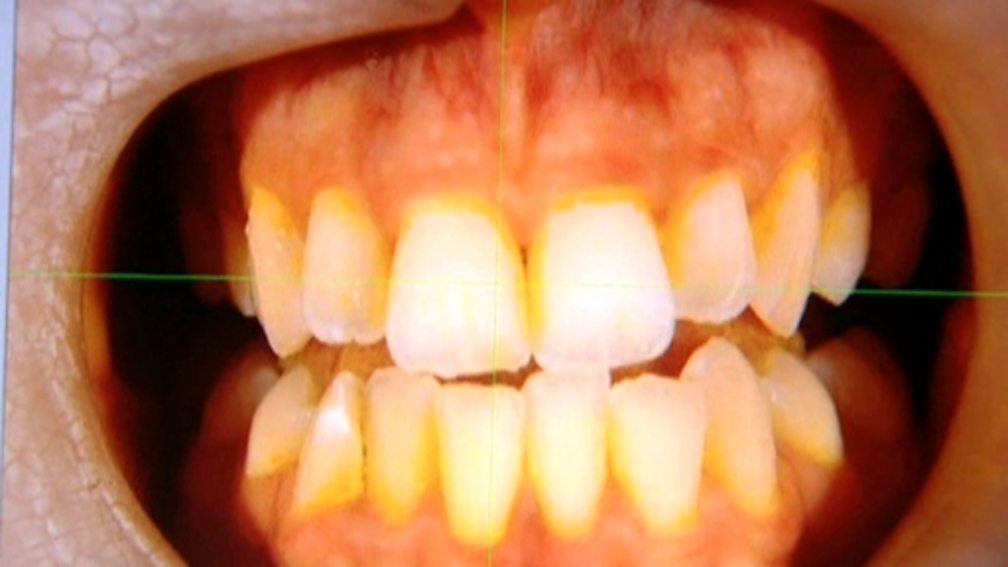 BBC Two Science Clips Investigates Teeth And Eating Clips