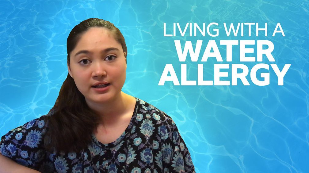 BBC Scotland The Social What it's like being allergic to water