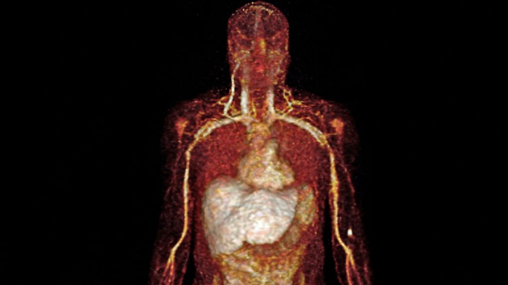 BBC World Service - Science In Action