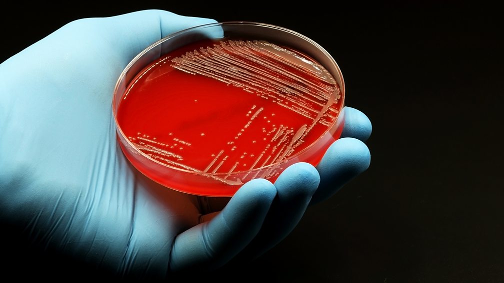 Getty Images Bacterial culture in petri dish (Credit: Getty Images)