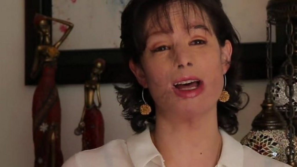 Colombian acid attack victim Natalia Ponce's long recovery BBC News