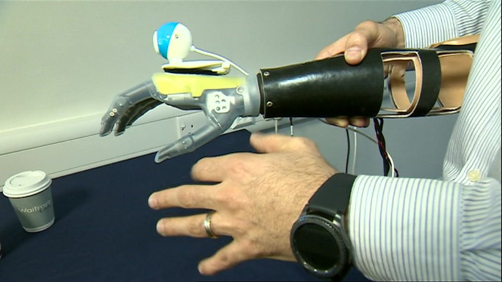 Bionic hand 'sees and grabs' objects automatically