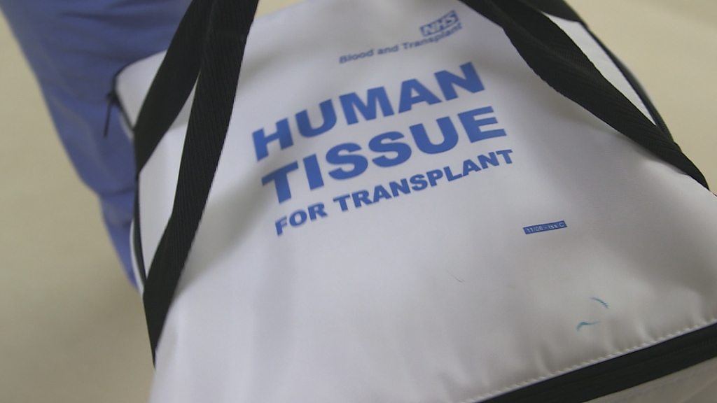 Opt-out organ donation system in Scotland planned