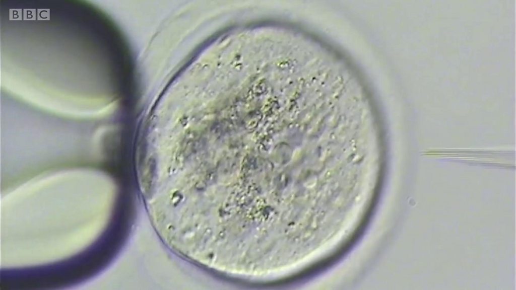 世界初のゲノム編集赤ちゃん」の正当性主張 中国科学者 - BBC