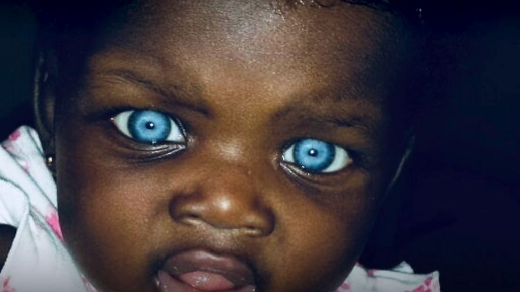 I saw an African American with blue eyes, how did that happen? Is