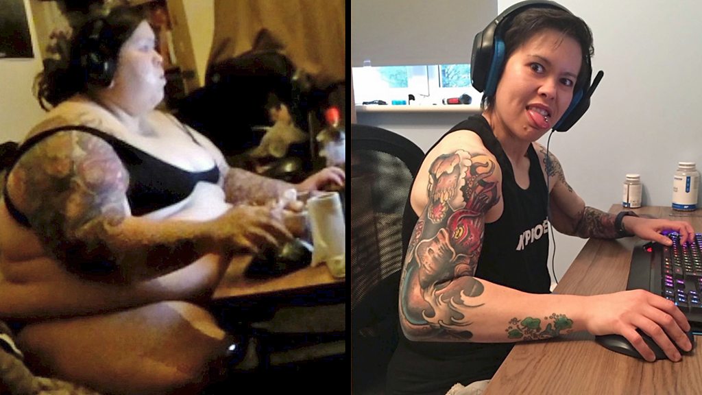 Adelgacé 120 kilos pero odio la piel que me sobra