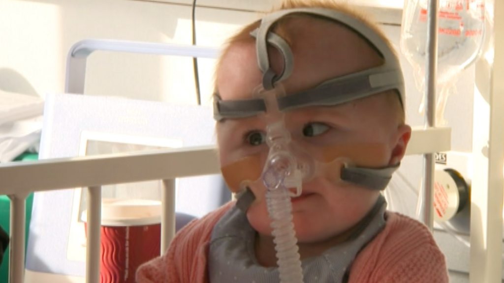 Baby born with heart outside body is home in Bulwell