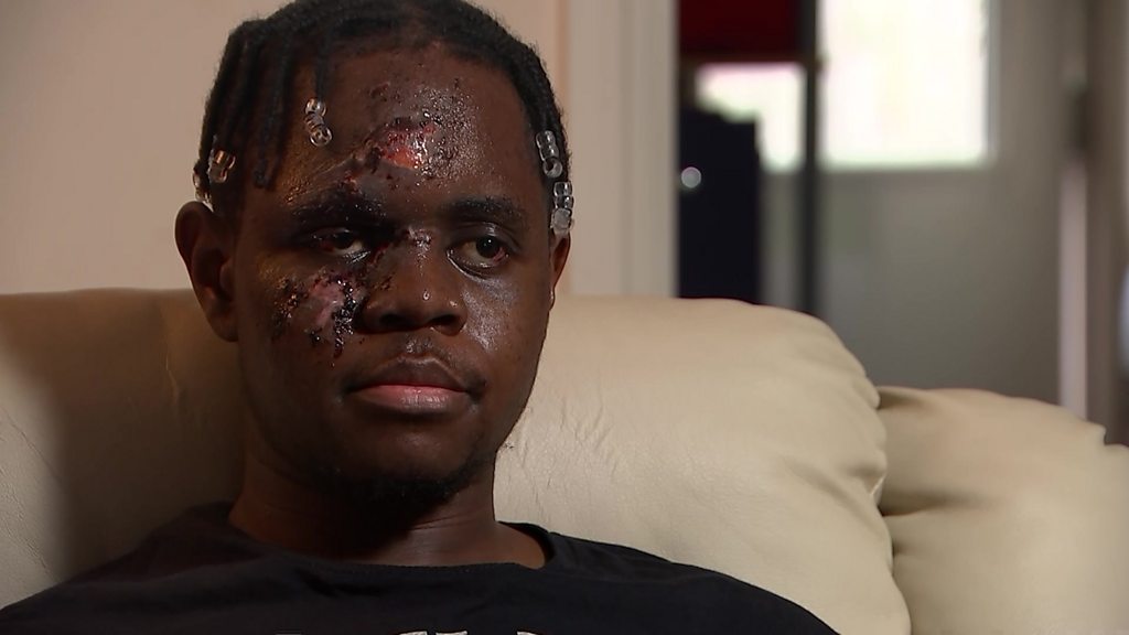 Bristol race attack victim K-Dogg 'glad to be alive'