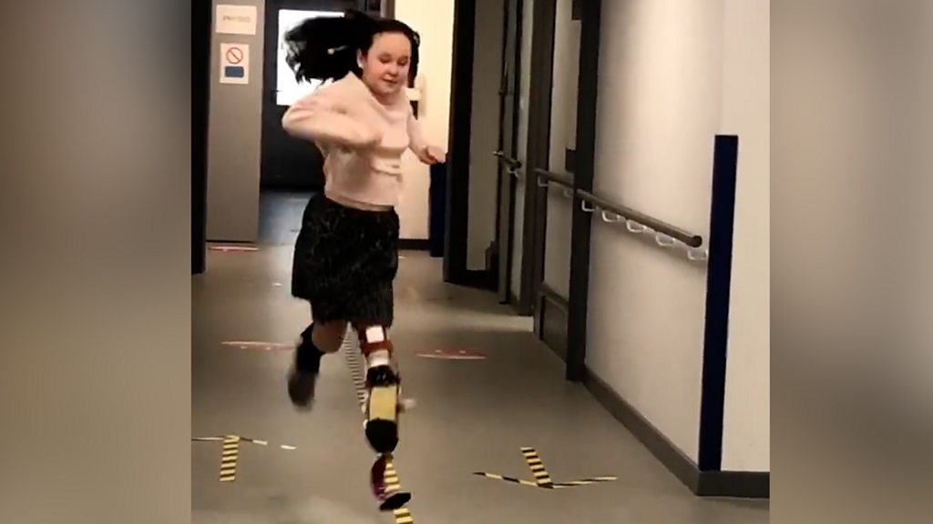 Crowborough woman becomes the first in the UK to get a new generation of prosthetic  leg – Crowborough Life