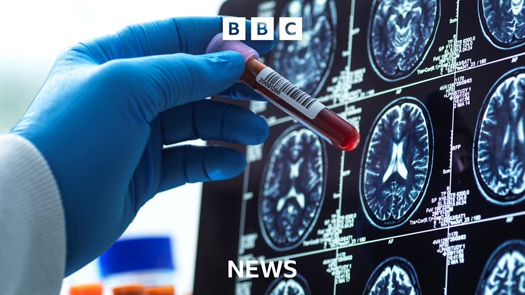 Why new Alzheimer's drugs won't be available on the NHS - BBC Sounds