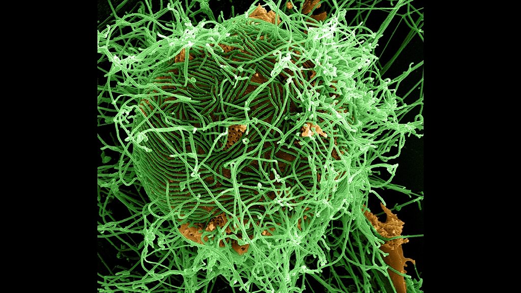 BBC Audio | Global News Podcast | What we know about latest Ebola outbreak