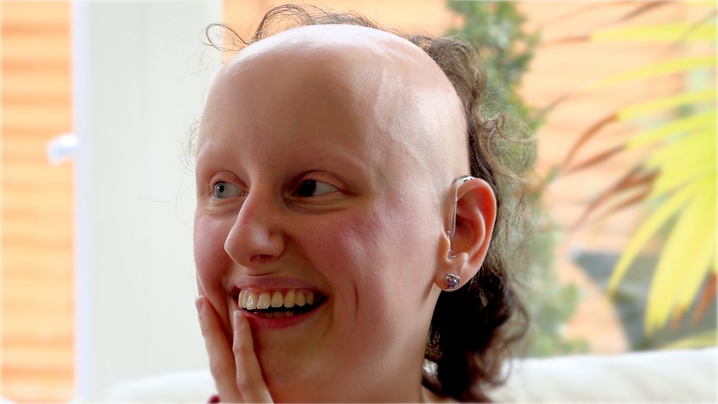 Alopecia patient calls for bald emoji to help represent hair loss - BBC News