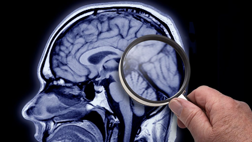 How motherhood changes the brain