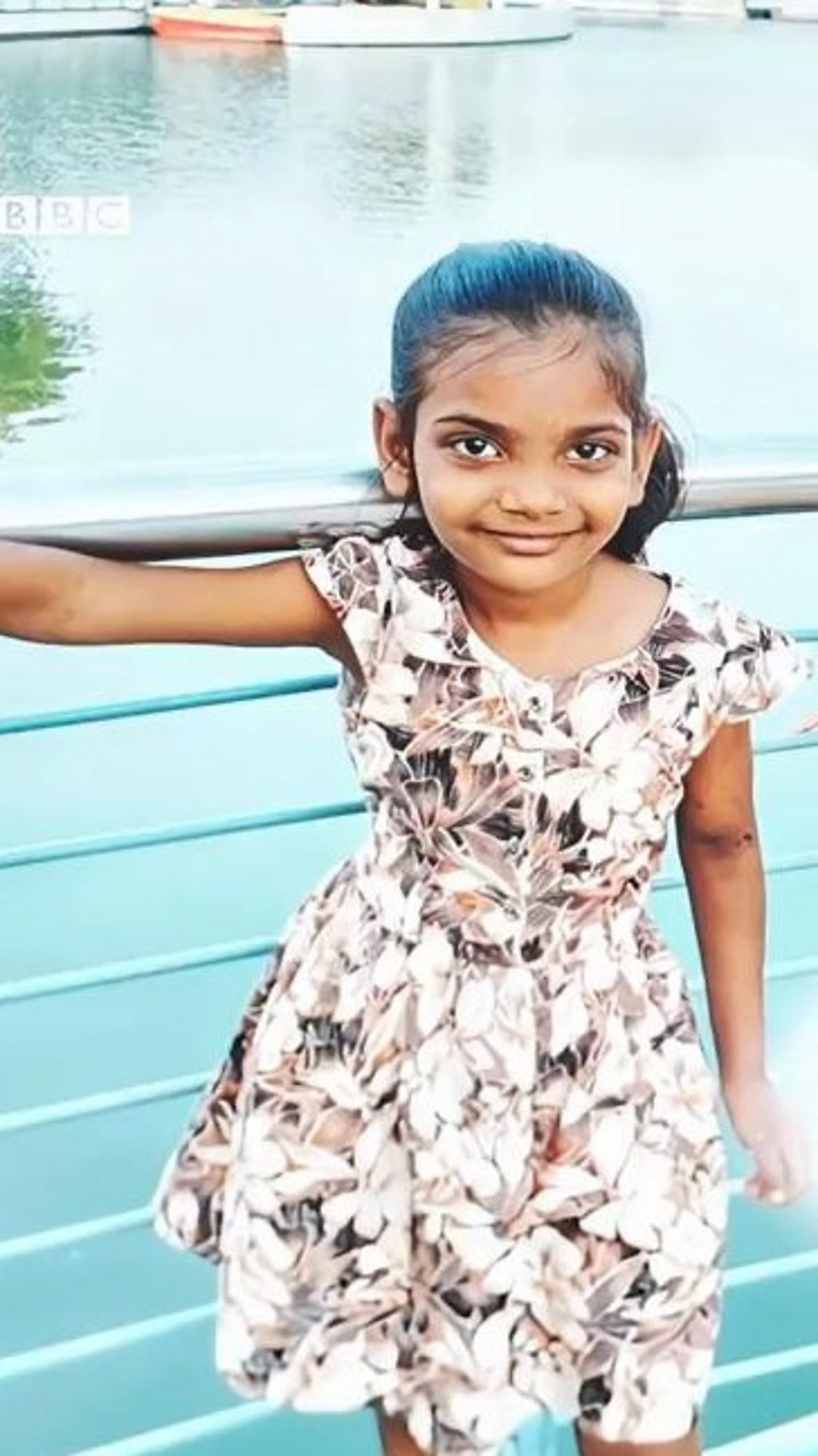 छह साल की इस बच्ची को कुत्ते ने काट लिया था