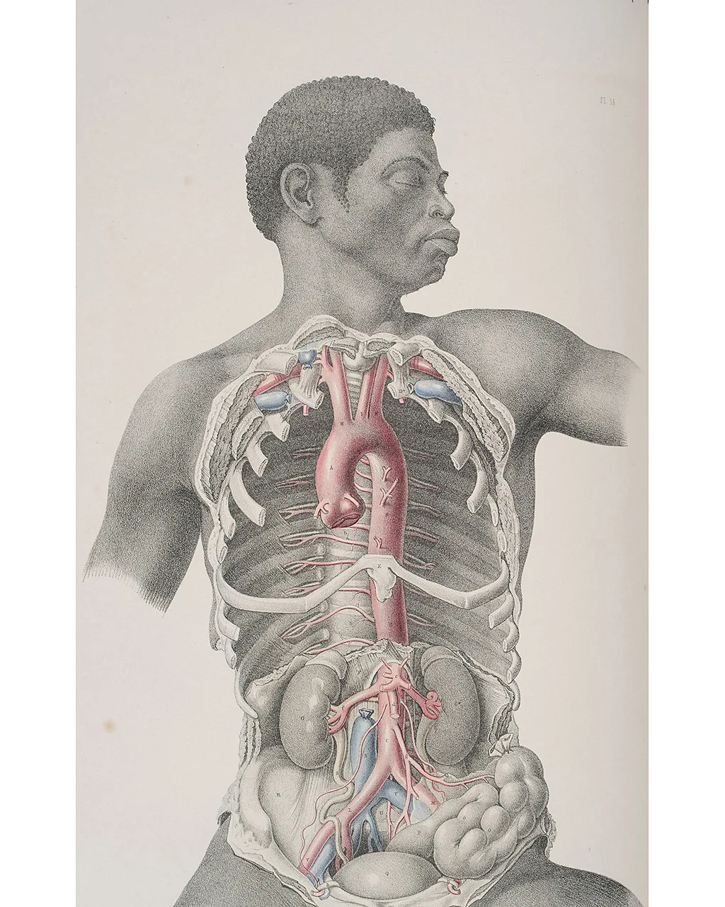 The meticulous works of Maclise are included in an exhibition at the Thackray Museum of Medicine (Credit: Mark Newton Photography)