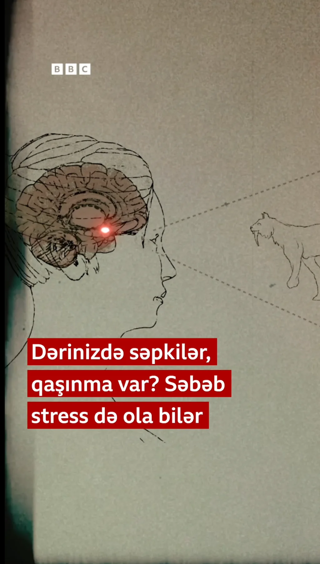 Dərinizdə səpkilər, qaşıntı var? Səbəb stress də ola bilər