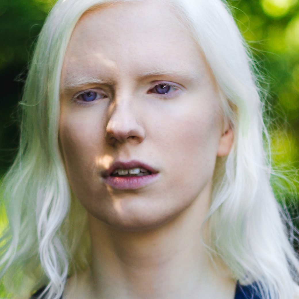 BBC Scotland - The Social - Spoken word helps me express my experience of  albinism