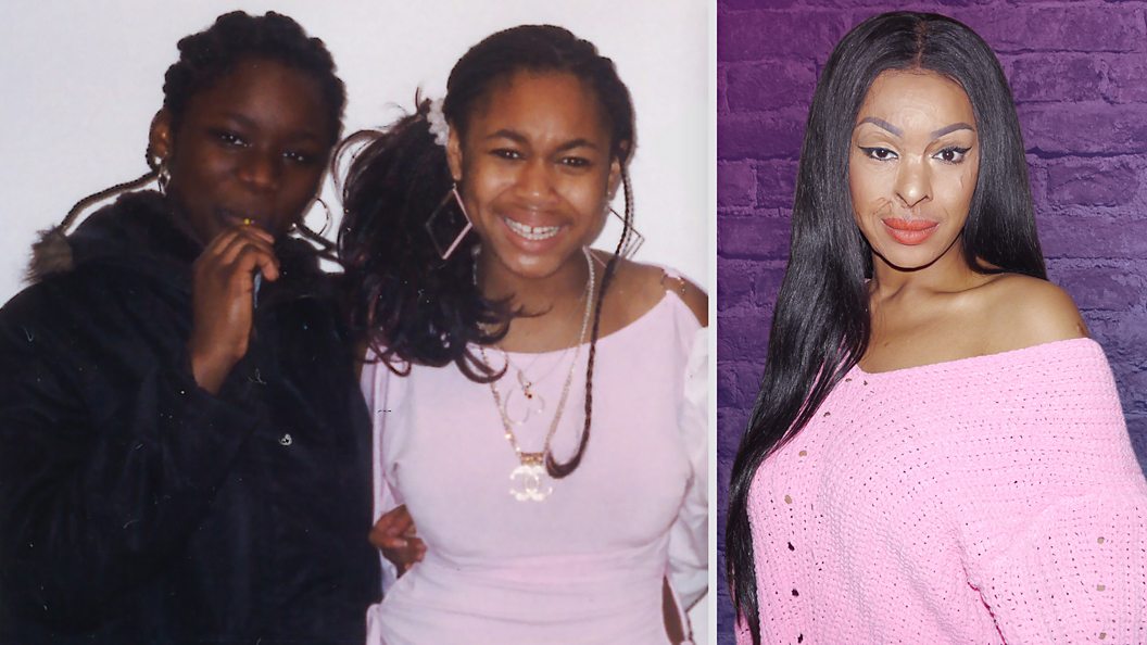 My friend threw acid in my face BBC Three