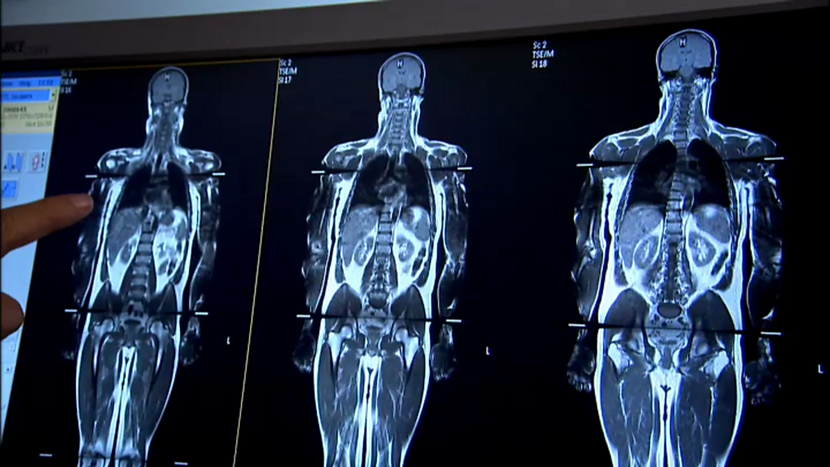 BBC Two - The Men Who Made Us Fat, Episode 1, Jacques's MRI scan