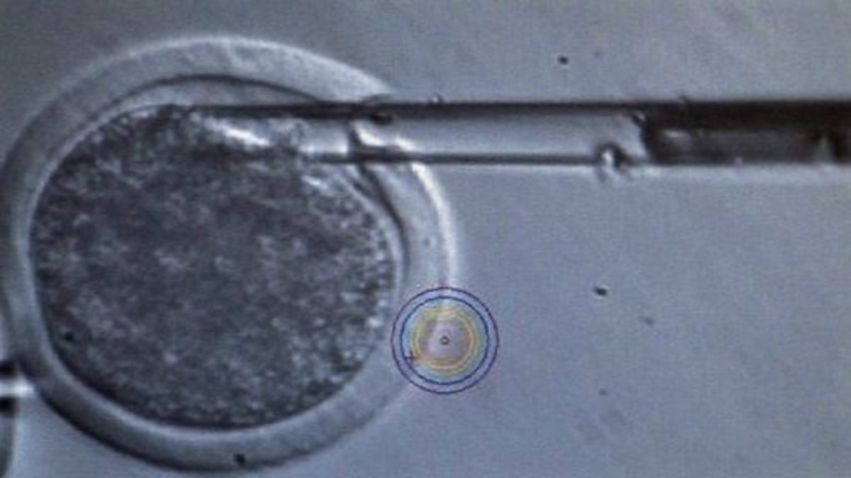 BBC Two iScience, Identical twins and cloning