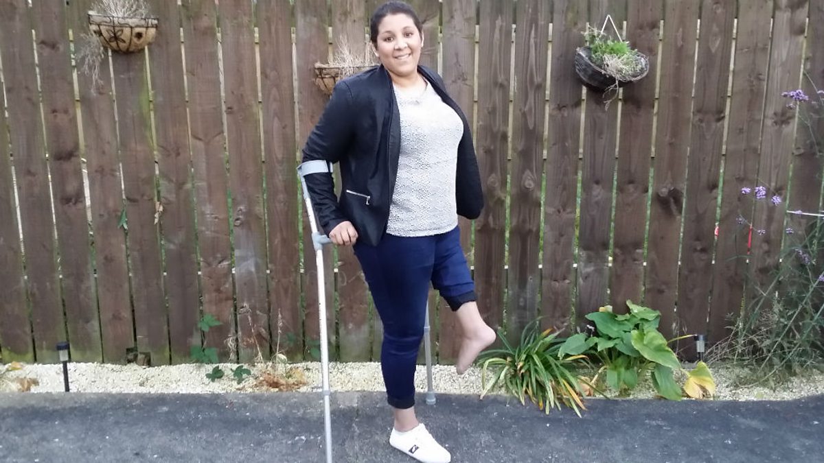 Bbc Radio 5 Live In Short Amputee Gets A New Knee Using Her