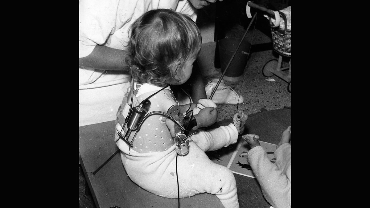 Bbc World Service Witness History The Thalidomide Trial