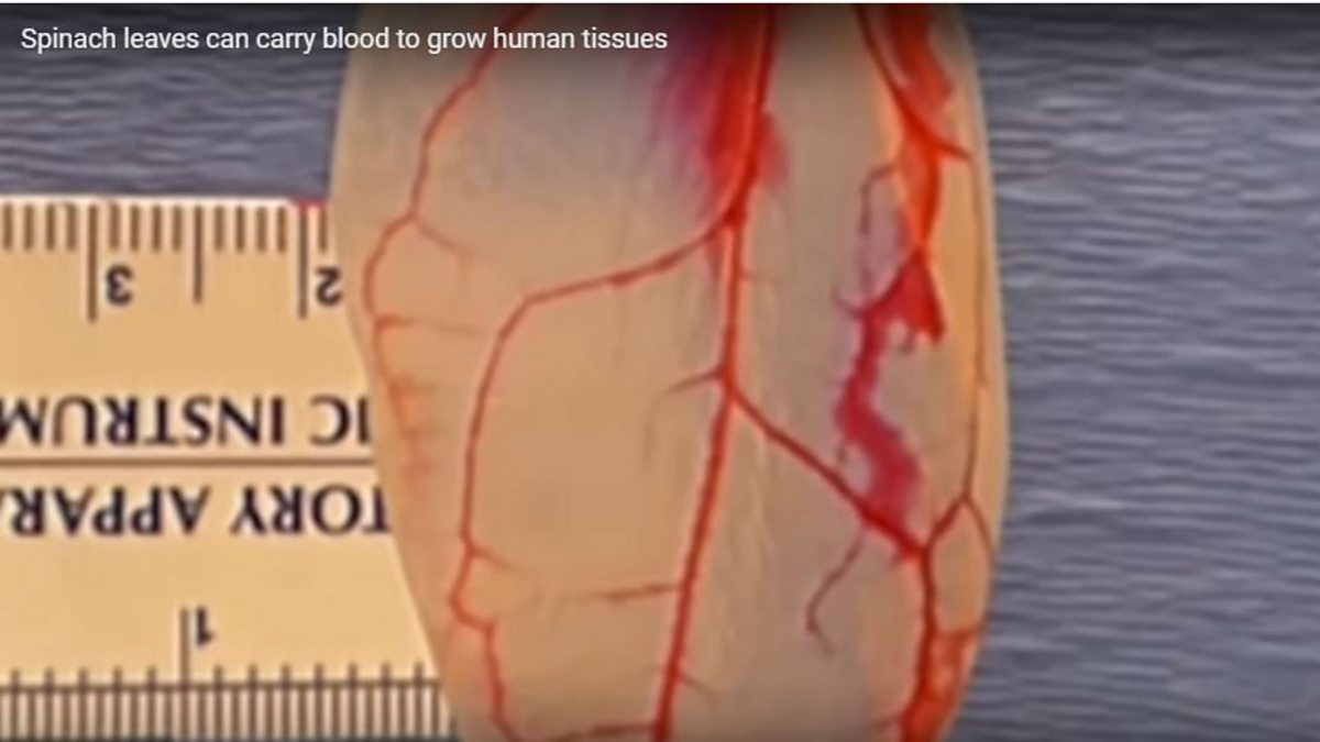 BBC World Service Newsday, The spinach leaf that grows into heart tissue