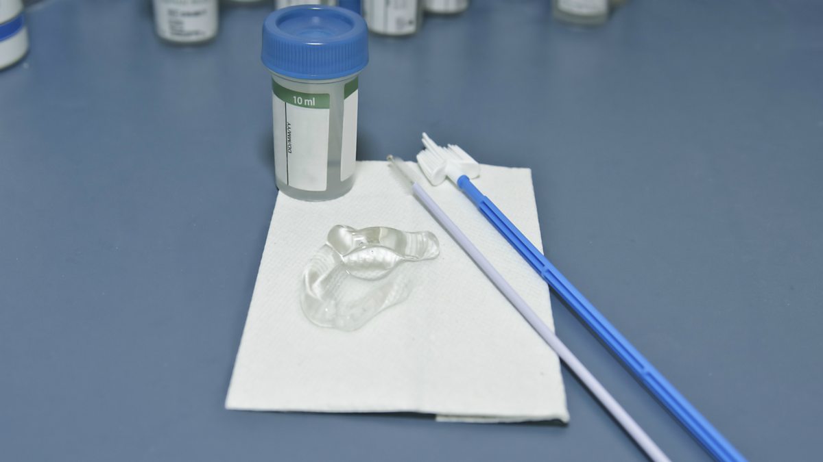BBC World Service Health Check What’s the Irish Cervical Check