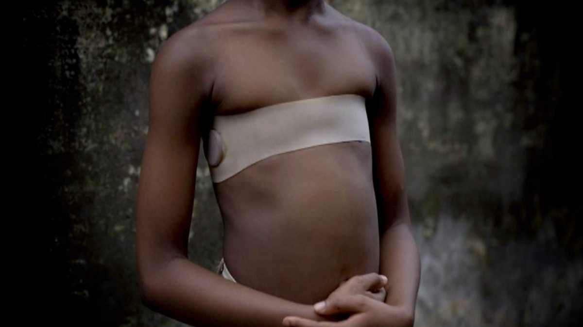 BBC Two - Victoria Derbyshire, Breast ironing awareness 'needed in schools'
