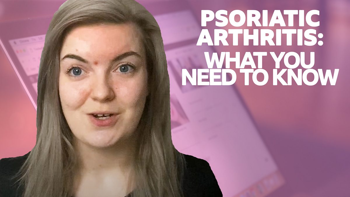 BBC - The Social, Scotland, What Is Psoriatic Arthritis?