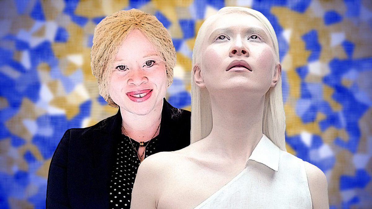 BBC World Service - The Conversation, Albinism: Dispelling The Myths