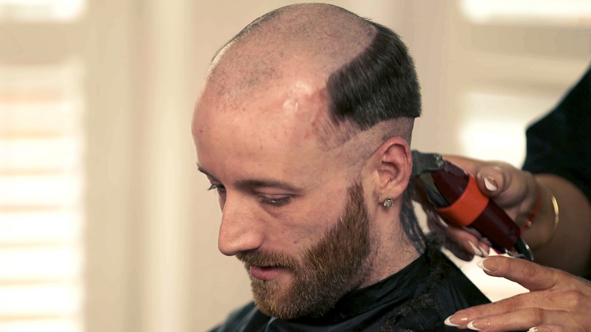 BBC One for Bald Men