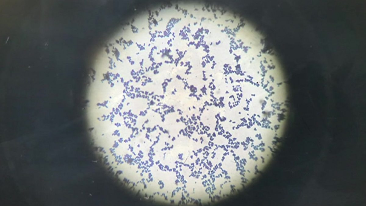 BBC Everything you need to know about Strep A