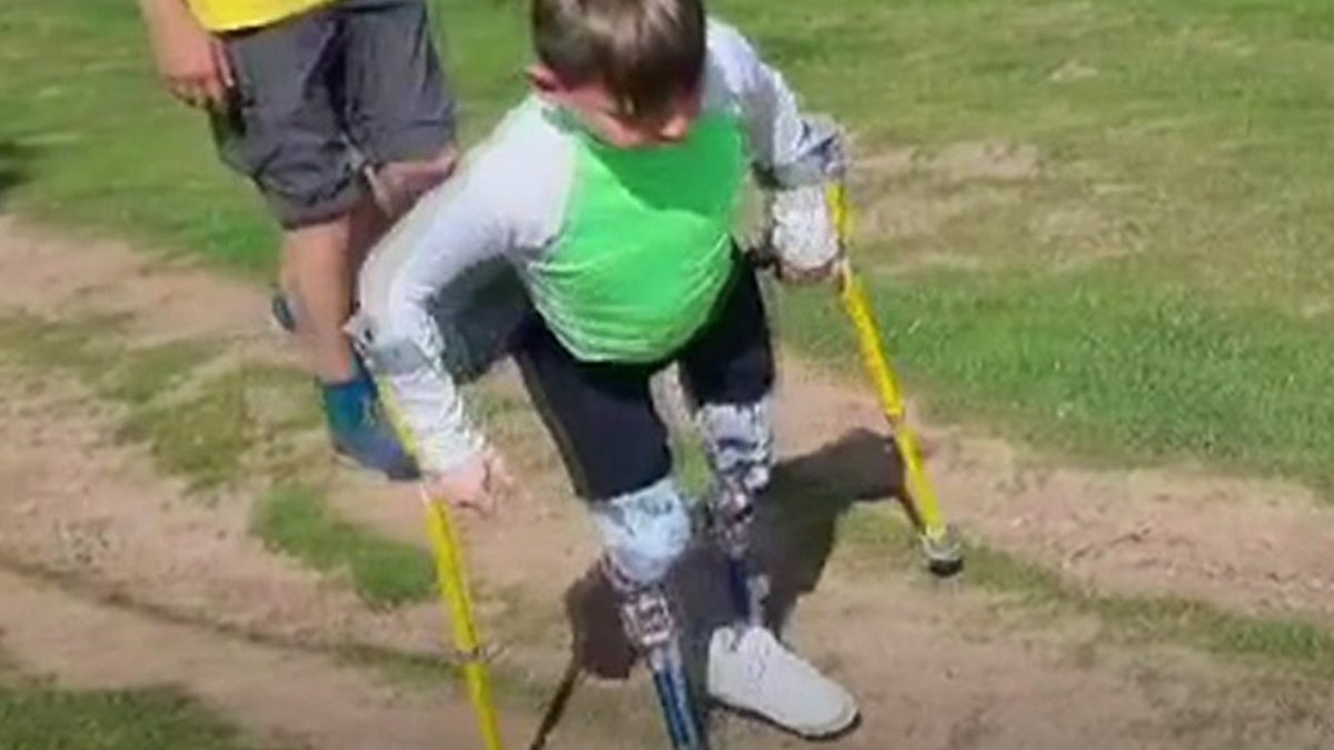 BBC - 8-yr-old amputee to scale his first Lakeland fell