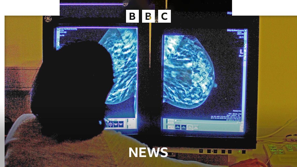 BBC NHS England expected to scrap many cancer targets