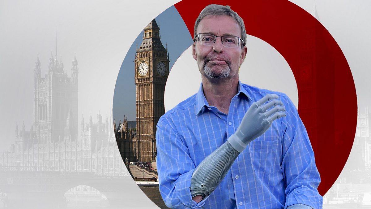 The Interview Decisionmakers Craig Mackinlay MP Losing My Hands