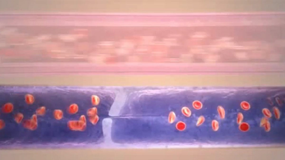 Exchange of materials Structure and function of arteries, capillaries