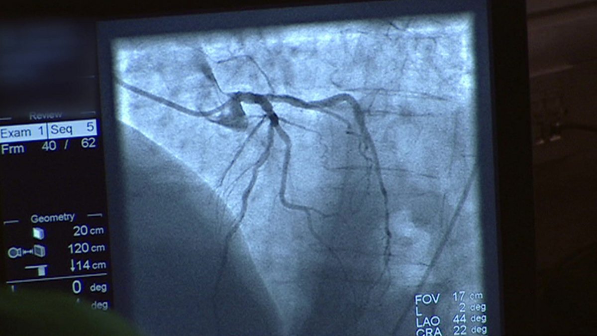 c Learning English 英语大破解 Dangerous Heartbeat Spike Lee And The Oscars 危险的心跳 斯派克 李抵制奥斯卡